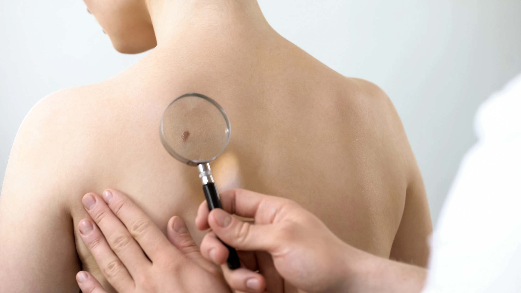 Kdaj na pomoč priskoči dermatolog in kako nam lahko pomaga